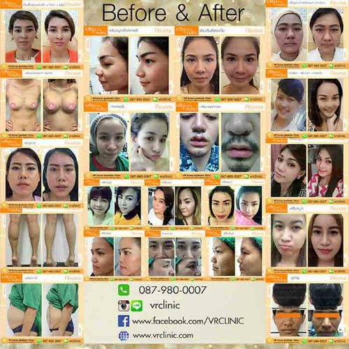 เปลี่ยนความกังวลใจ..ให้เป็นความมั่นใจ Designed By VR Clinic